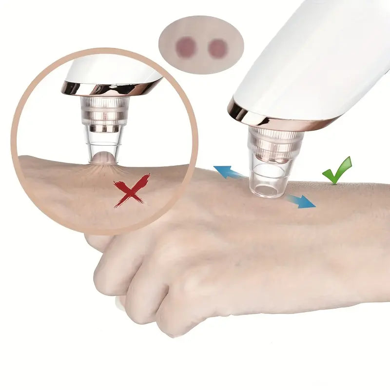 🧼 Mini Blackhead Remover Vacuum – Pore Cleaner & Facial Suction Tool